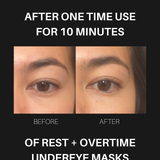Overtime Undereye Masks